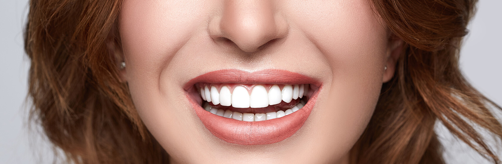 Traditional Veneers in Wynne, AR Toland Dental