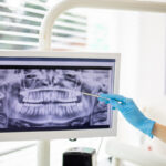digital x-rays, digital xrays, digital radiographs, dentist in Wynne