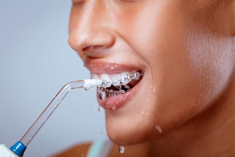 clean your teeth without floss with a water flosser